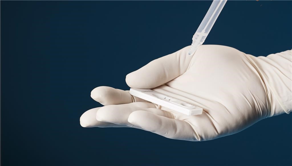 /images/temp/txt/laboratoryscientistperformingrdtrapiddiagnostictestantibodiesdetectpresenceviralproteinsantigensexpressedbycoronavirusdiseasecovid19rapidantibodydetectiontest.jpg